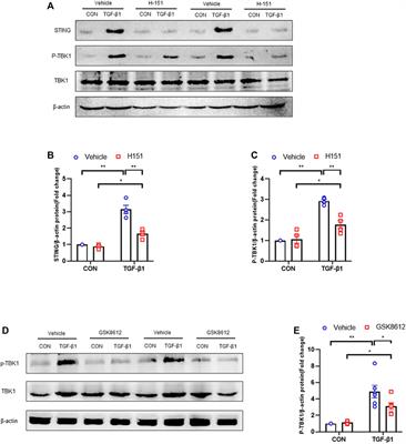 Pharmacological Inhibition of STING/TBK1 Signaling Attenuates Myeloid Fibroblast Activation and Macrophage to Myofibroblast Transition in Renal Fibrosis